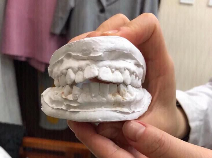 FB體育 FB體育平臺湖北戶口值錢了！矯正牙齒、種植牙補貼已發！人人有份！(圖6)